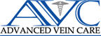 varicose vein treatment